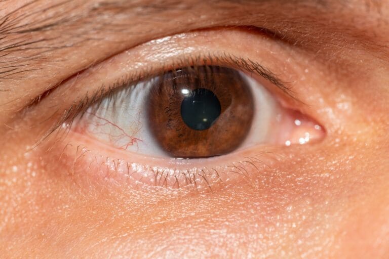 Zapalenie rogówki wywołane przez Acanthamoeba – dlaczego woda z kranu jest groźna dla soczewek?